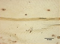 Aerobryidium taiwanense Nog. Collection Image, Figure 9, Total 10 Figures